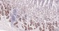 PI3-kinase p110 subunit beta Recombinant Rabbit mAb